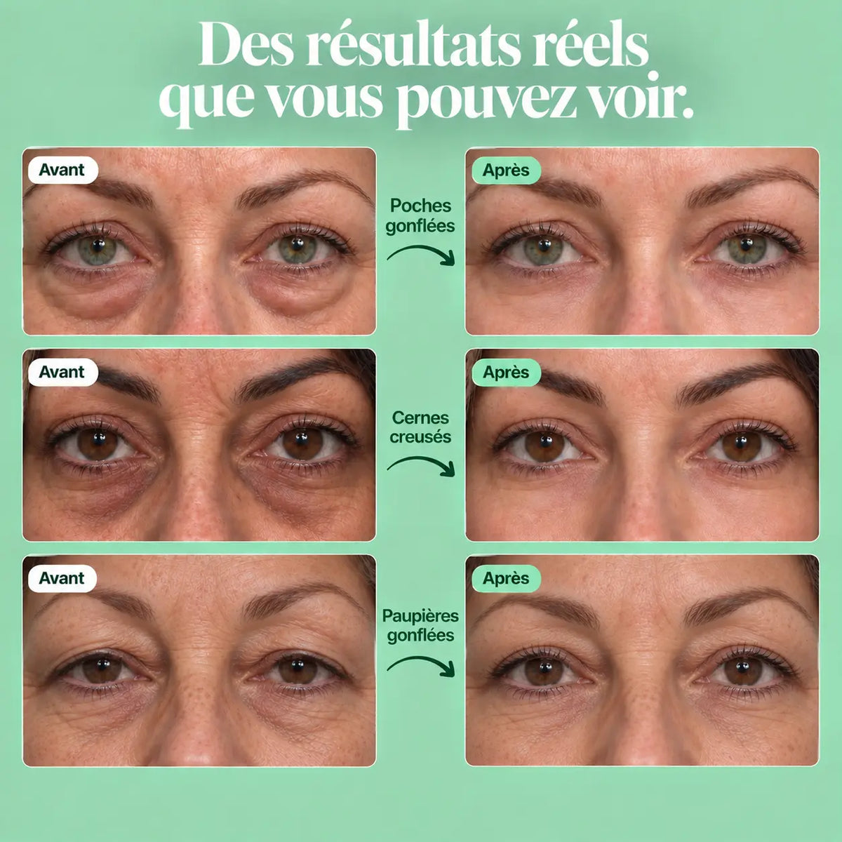 Soin Regard Bio-Collagène & Peptides™